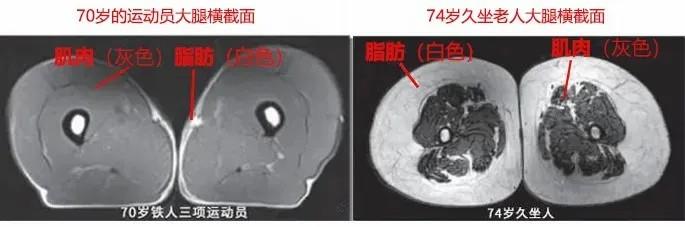 運動是加速衰老，還是延緩衰老？真相揭開